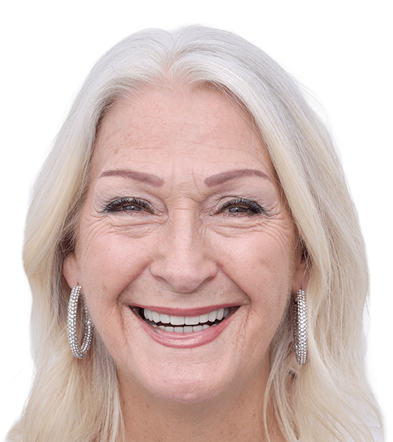 Smile Gallery