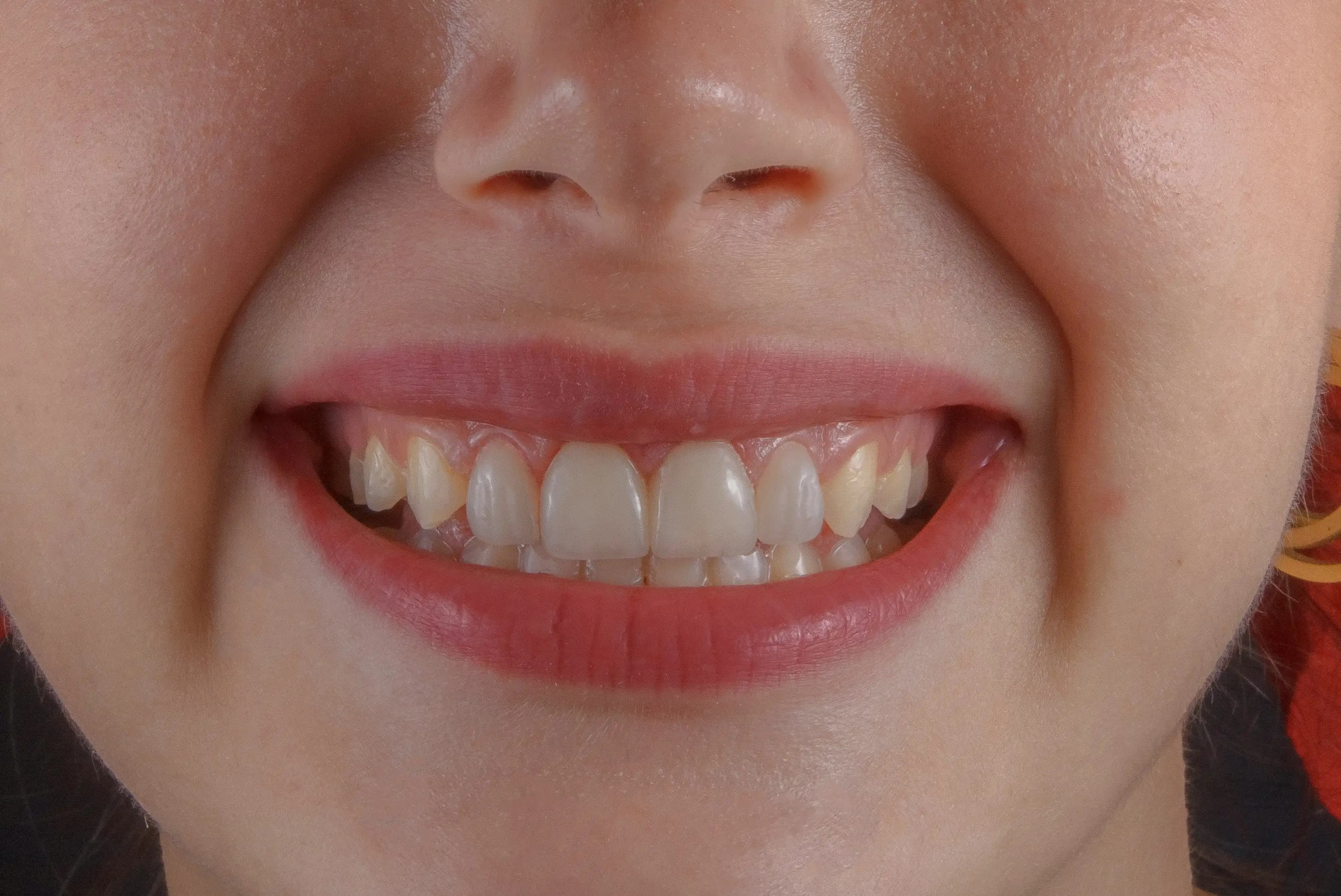 smilingface1