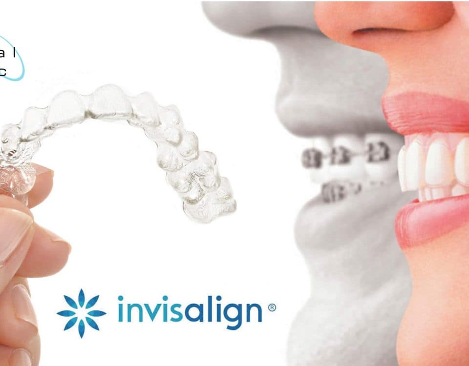 Invisalign Braces