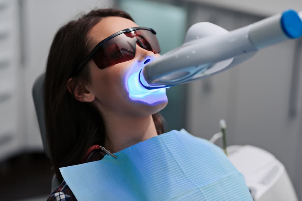 Teeth whitening