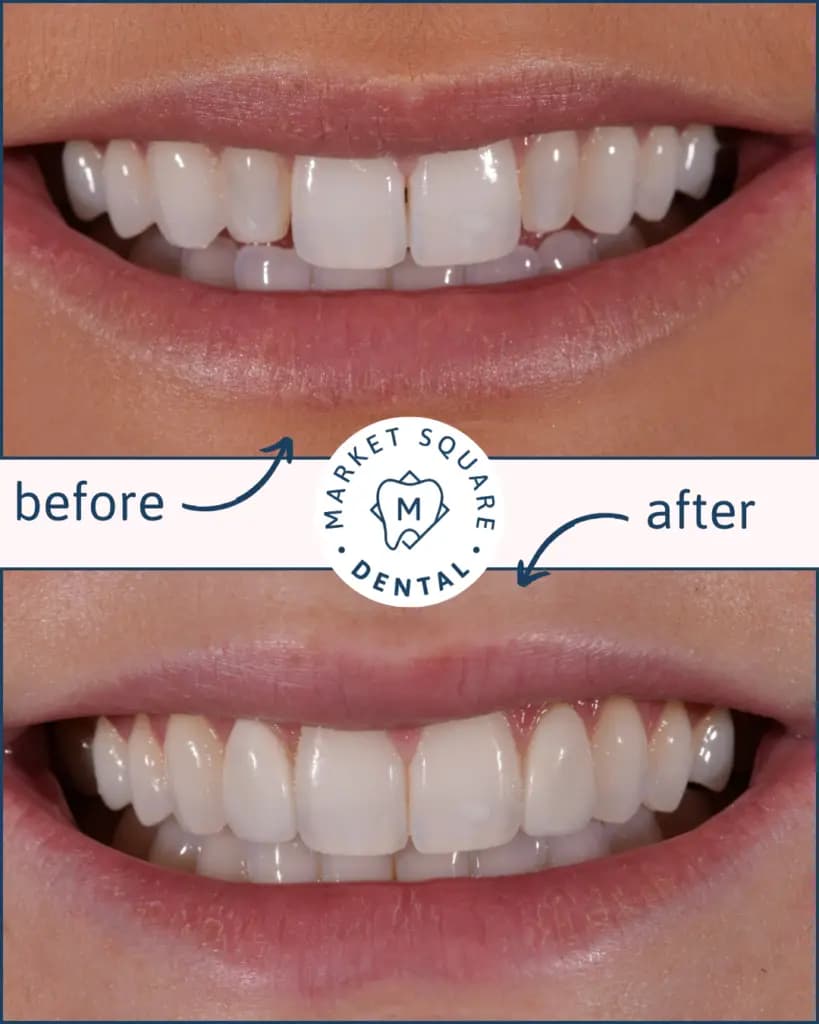 Copy of Cosmetic dentistry 1 1 819x1024