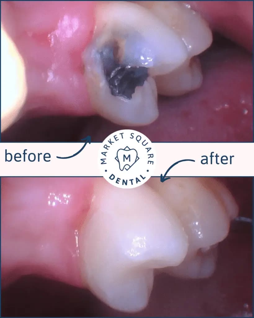 Copy of Filling min 819x1024