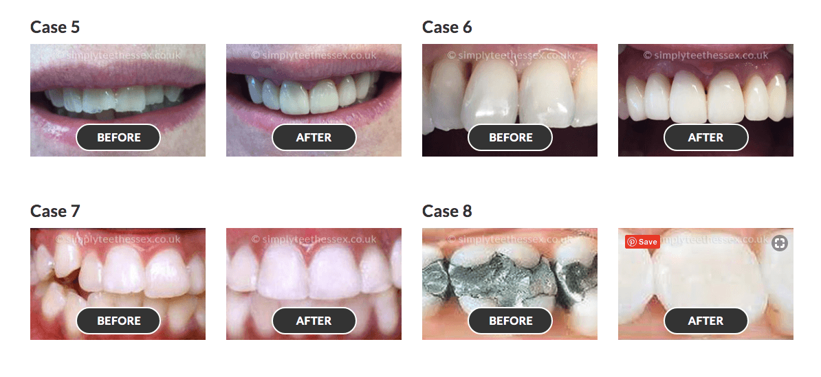 smile gallery 2