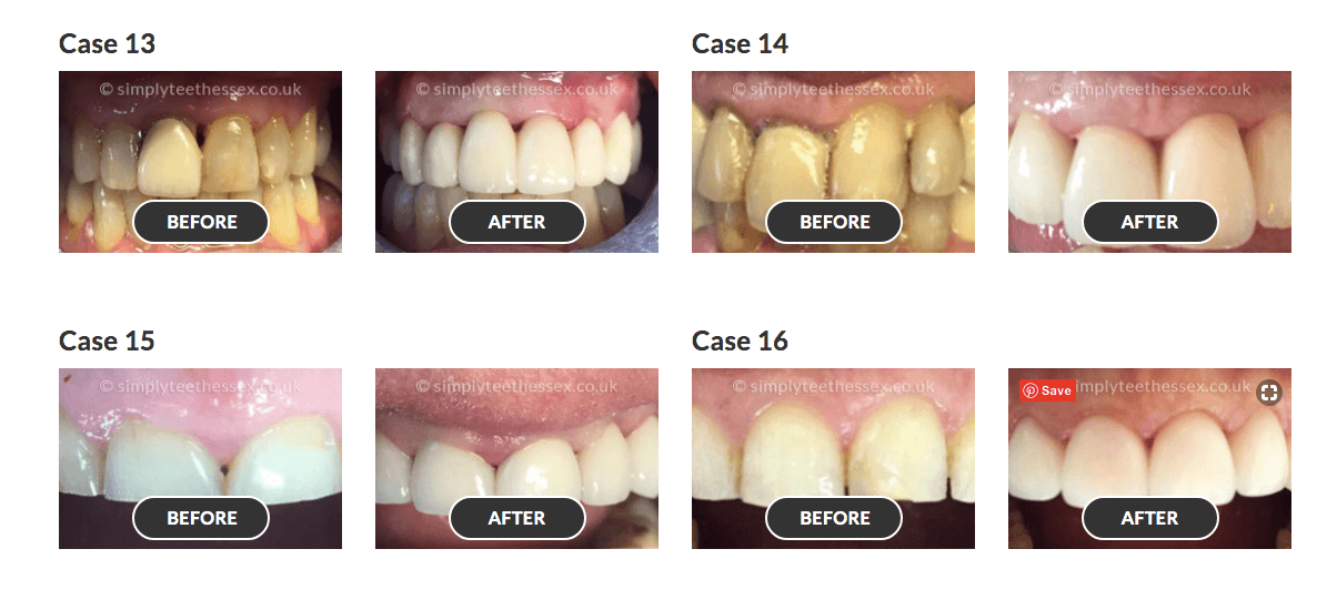 smile gallery 4