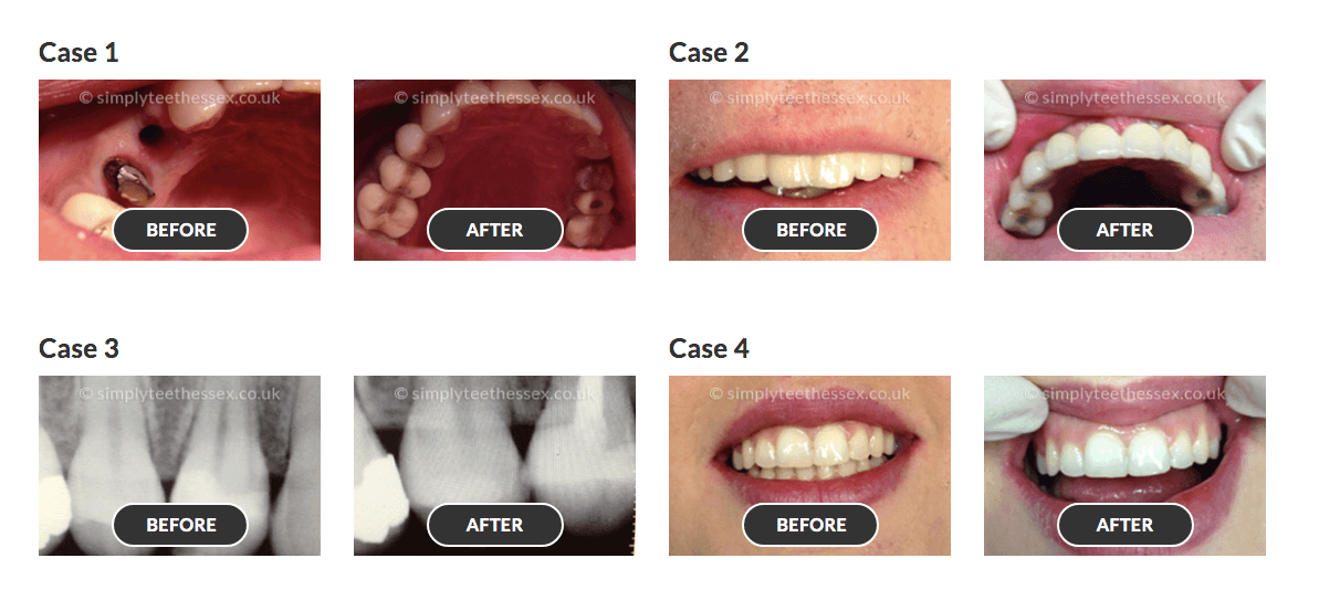 smile gallery 1