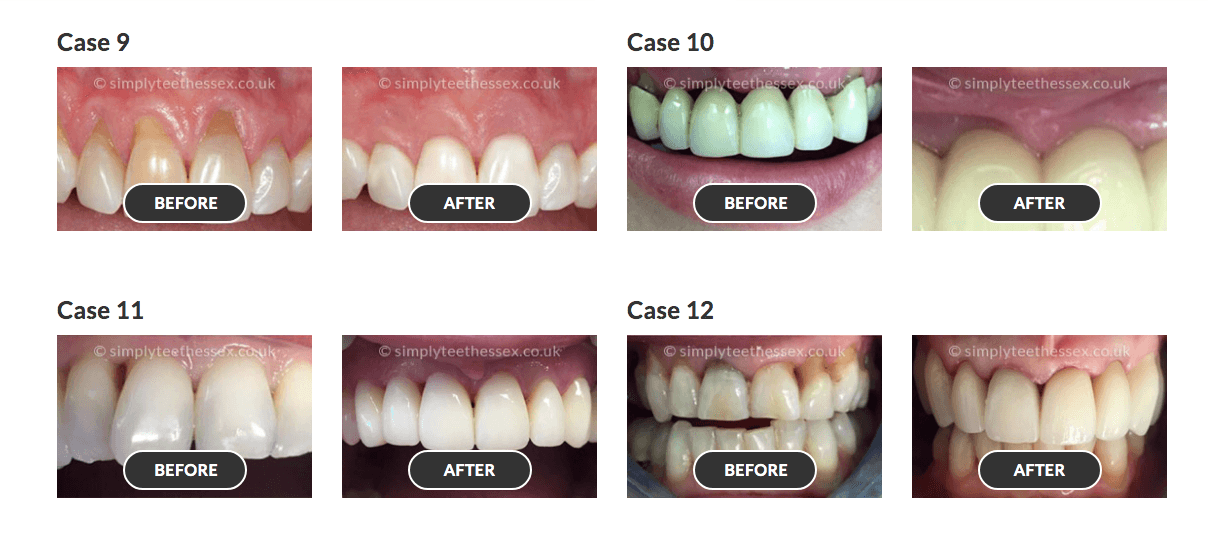smile gallery 3