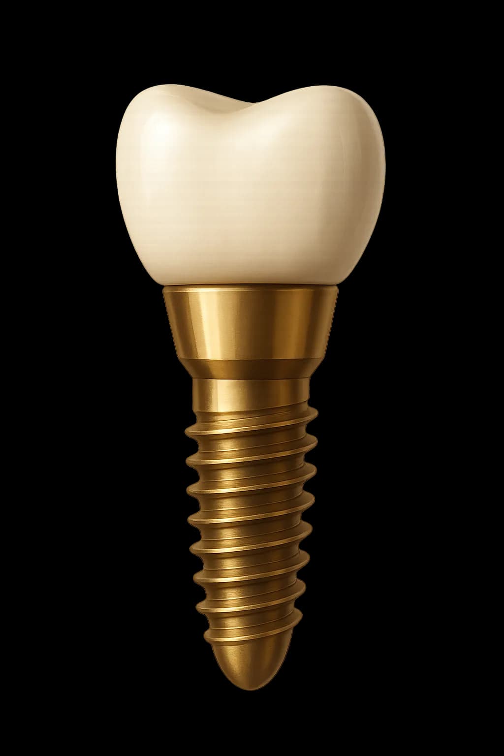Dental implant with golden screw and tooth colored crown