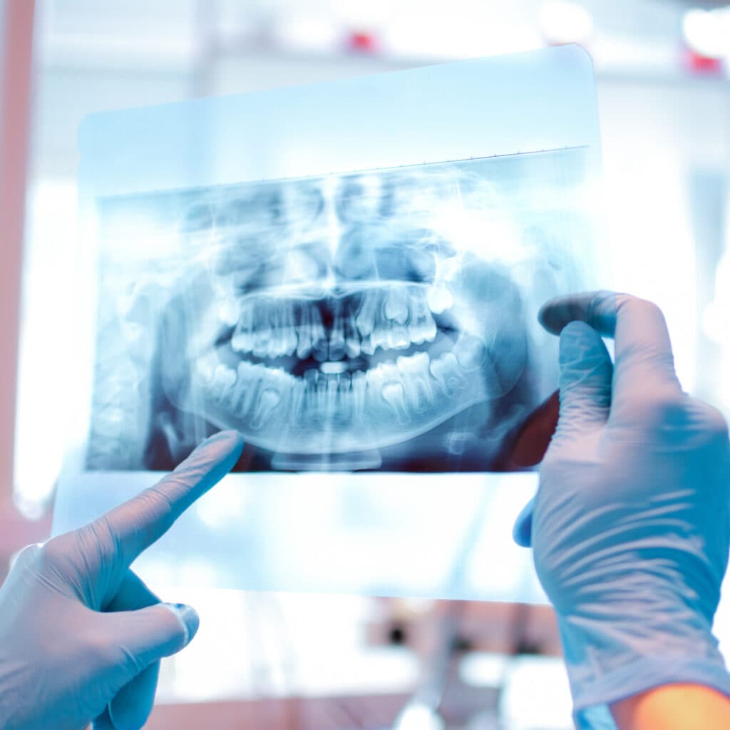 Person examining dental X ray in clinic.