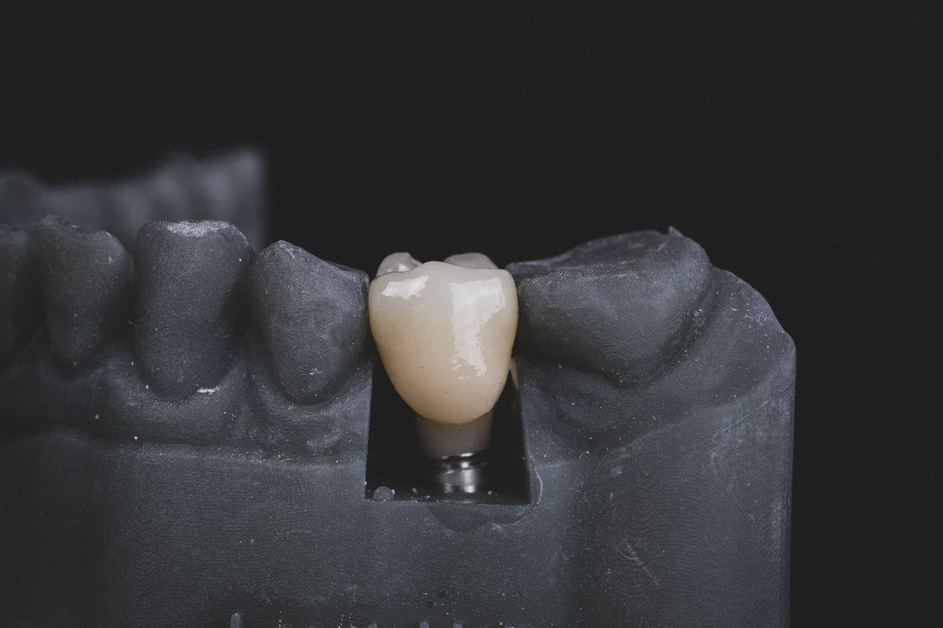 Image of dentist working on implants