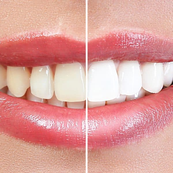 Richhill Dental Web Contents 1000x1000px CosmeticDentistry 600x600