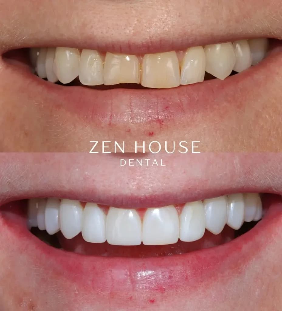 Patient before and after