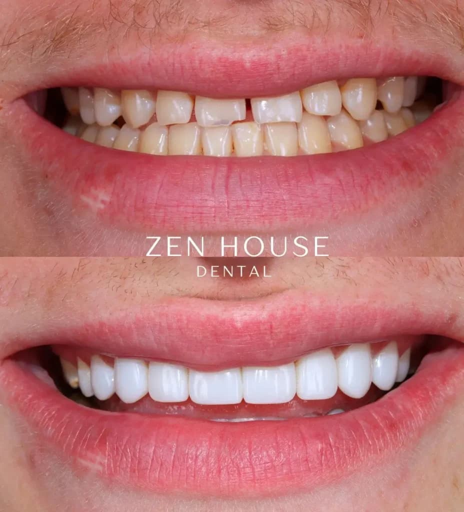 Patient before and after