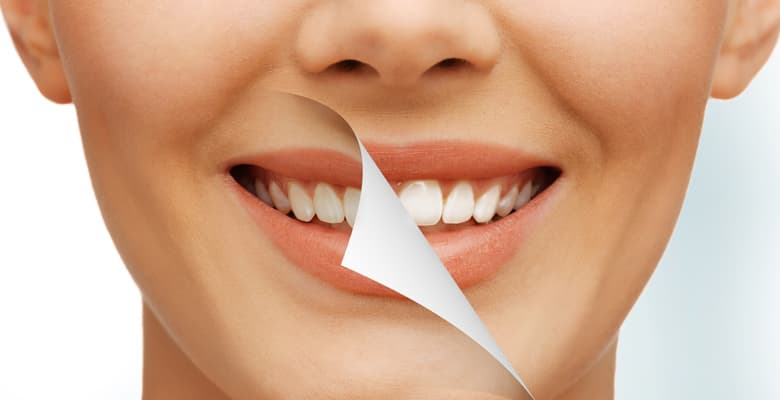 chestermere dental Cosmetic Dentistry