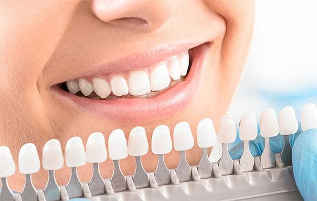 teeth whitening image