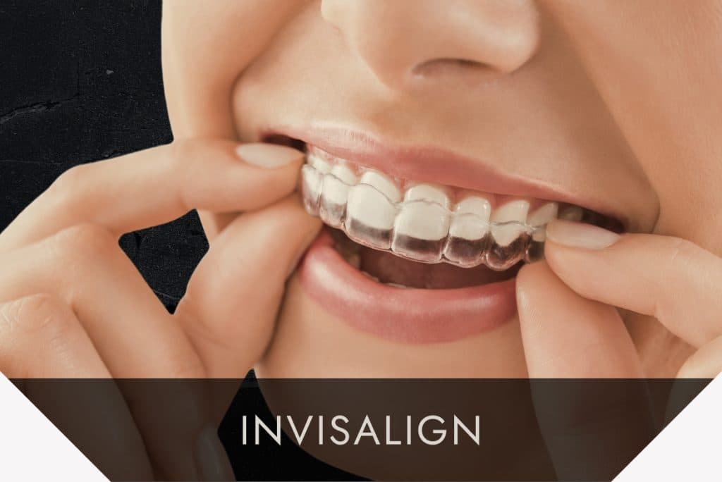Invisalign, invisible braces being fitted
