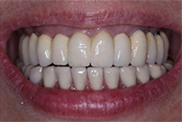 Private Dental Clinic Bristol