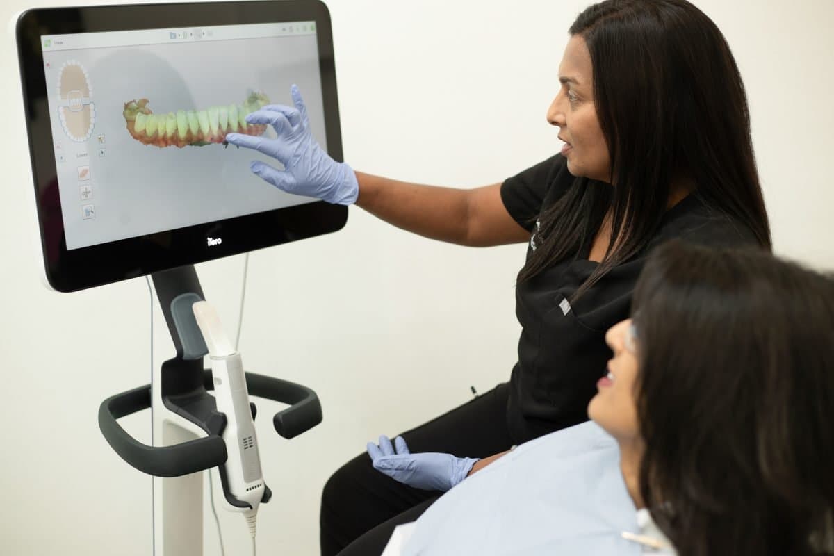 Invisalign Aligners