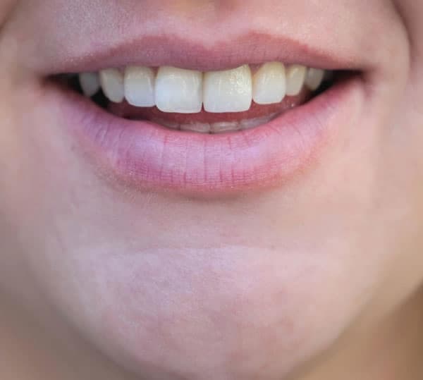 smile1