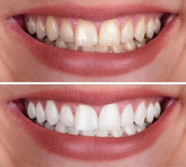 smile2