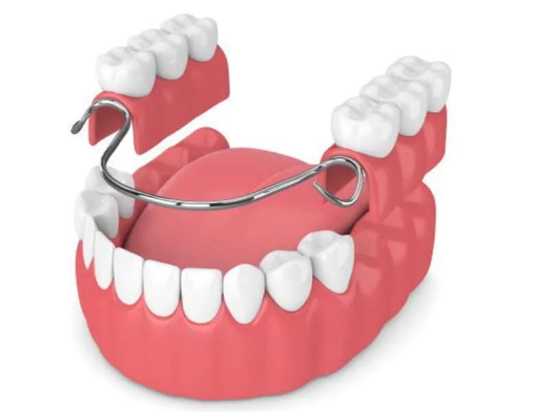dentures teeth leixlip