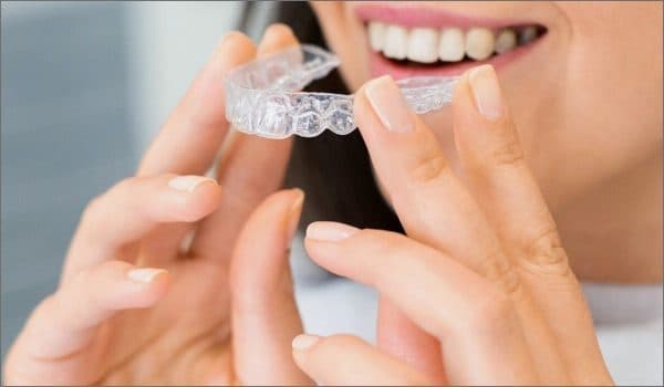 invisalign