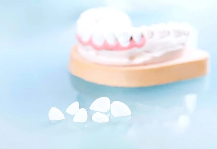 dental restorative treatment