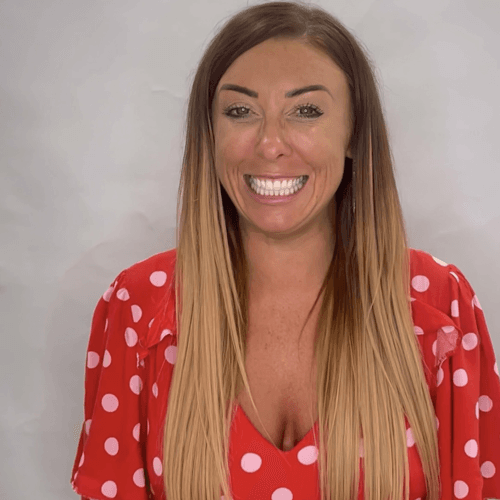 smile makeover1