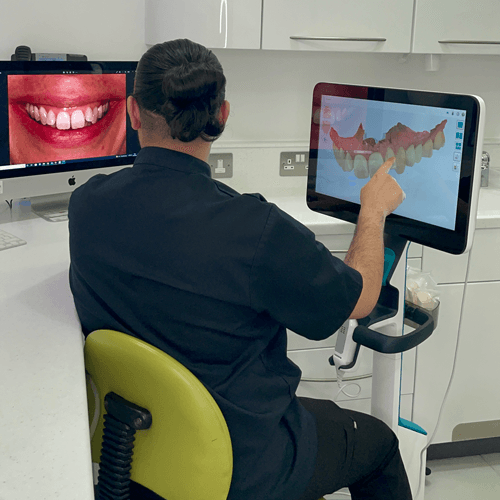 Dental implants1