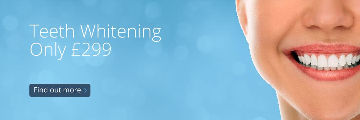 Teeth Whitening Only £299 Find out more