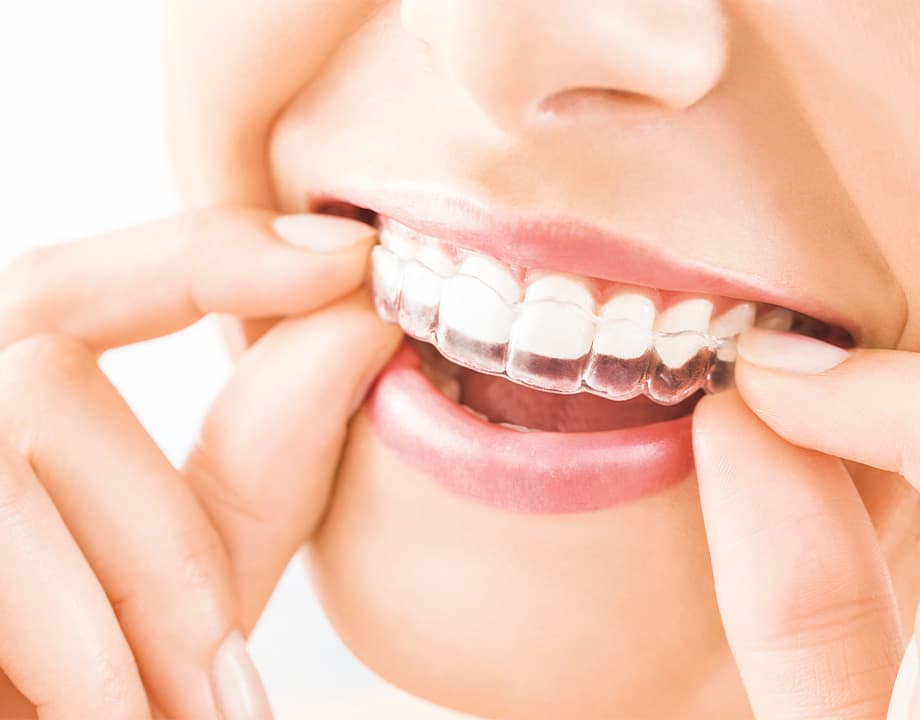 The Riley Dental Studio Invisalign Providers, Staffordshire