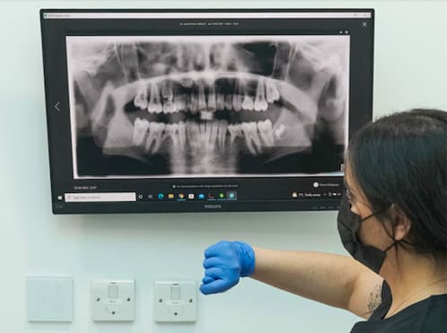 Implants with LYdental London City Bank Northwood