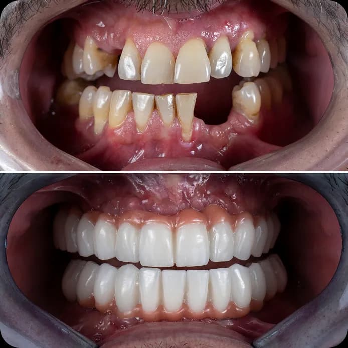 Dentist providing advanced cosmetic dental treatment in a modern dental clinic setting