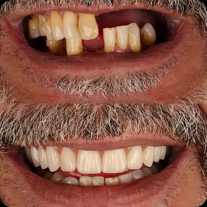 Dentist consultation with patient at modern dental clinic