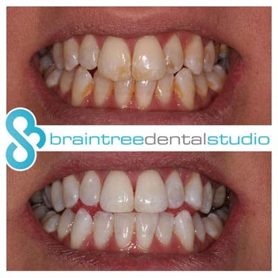 65e8e3321b824c4740d9e969 whitening 10