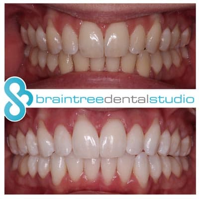 65e8e3321b824c4740d9e968 whitening 7