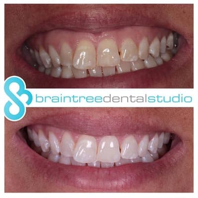65e8e3321b824c4740d9e96a whitening 14