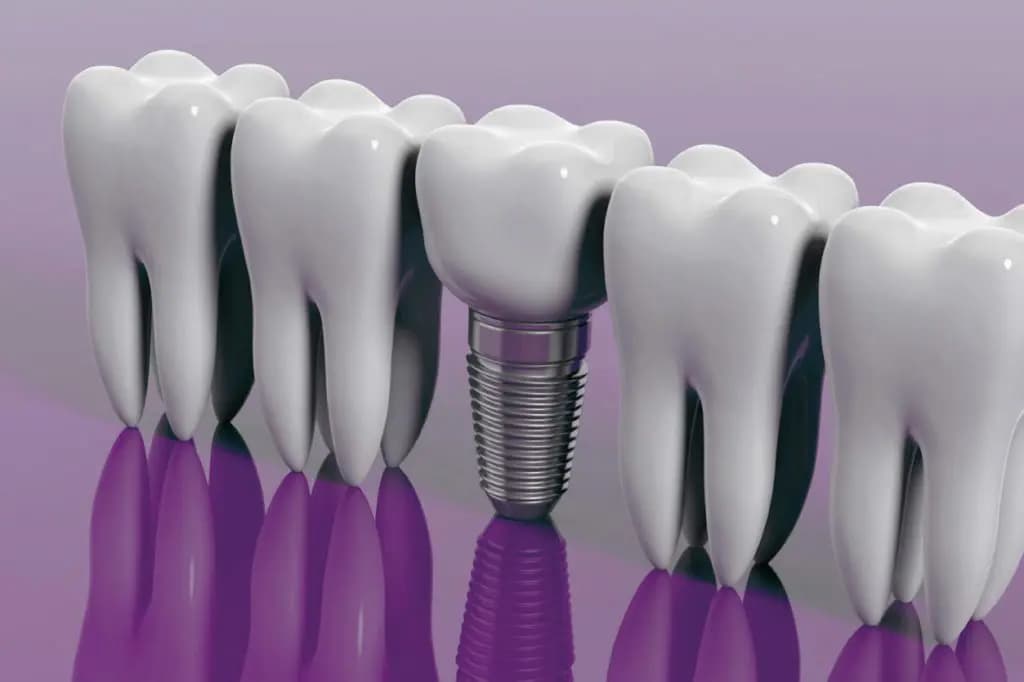 wadebridge dental implant dentistry 1024x682