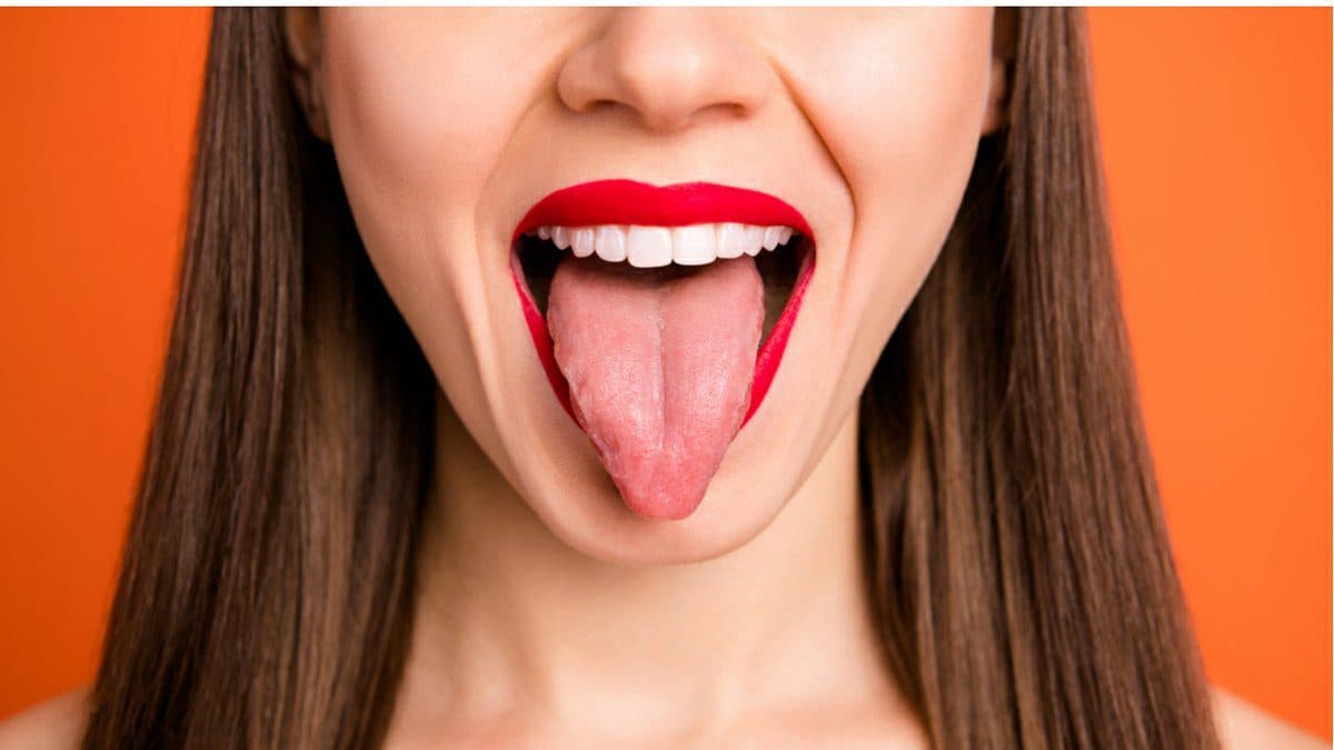 TongueDiagnostics