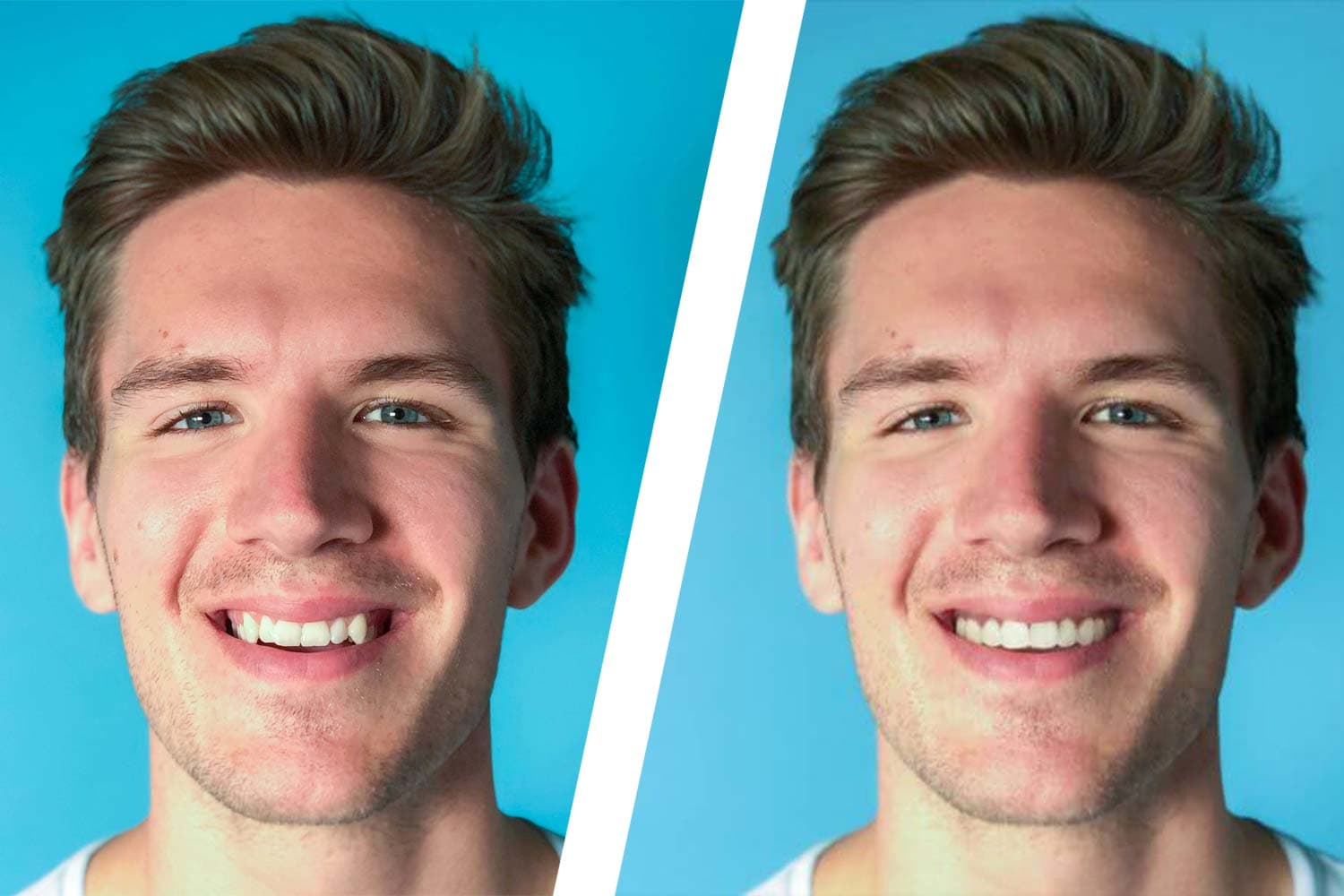 Before and after