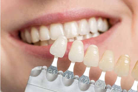 dental implants cover