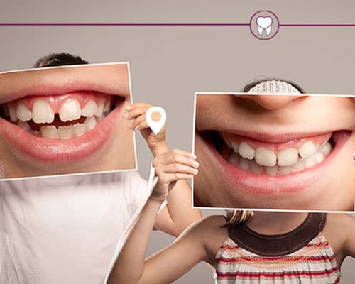pennyblack dental teeth