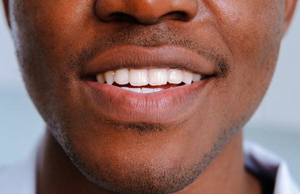 y bont faen teeth whitening