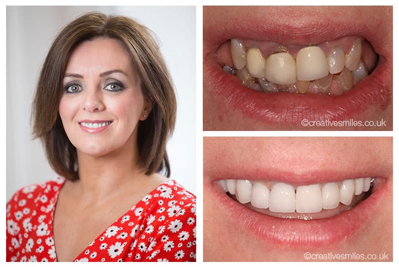 Dental Testimonials