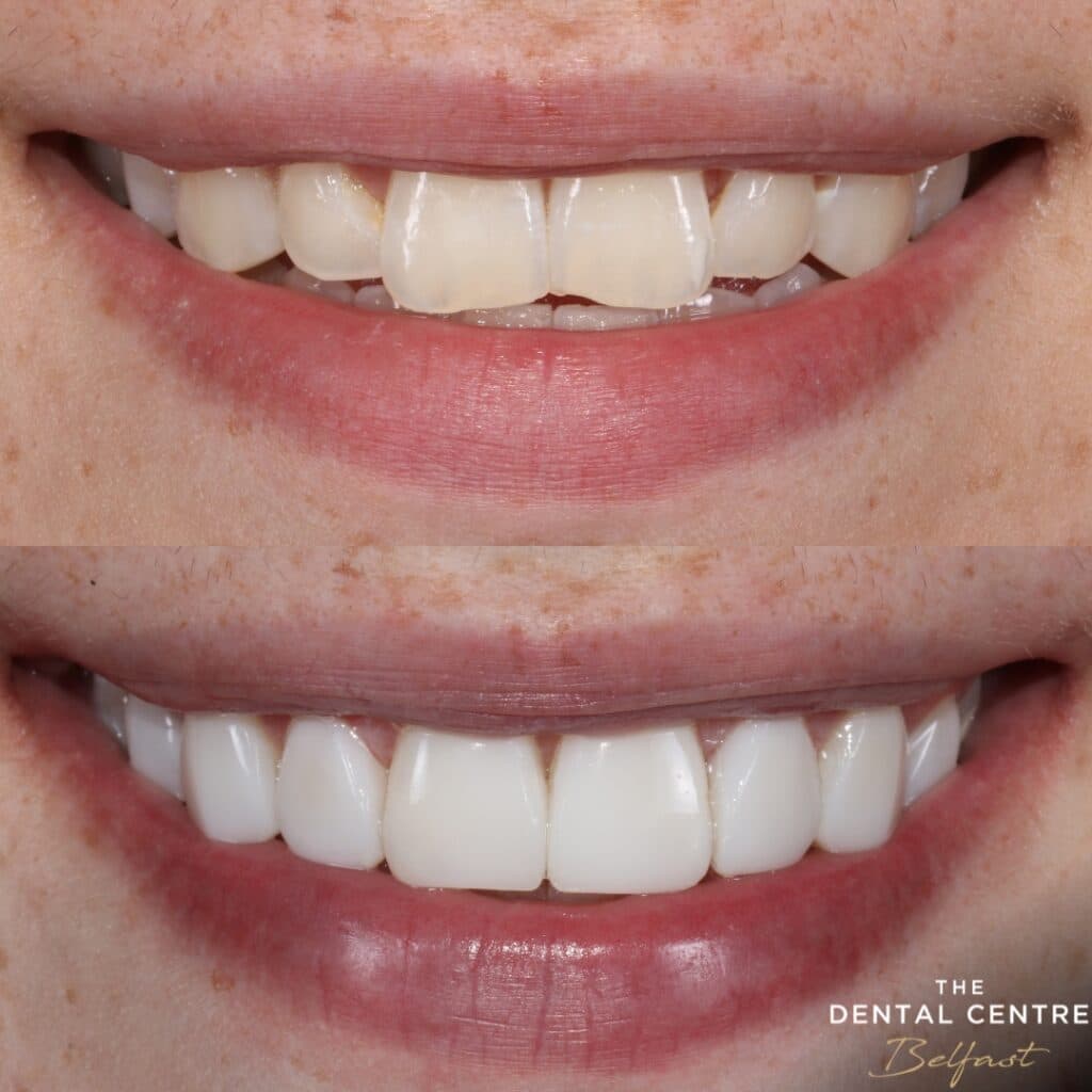 Smile Transformations 1 1024x1024